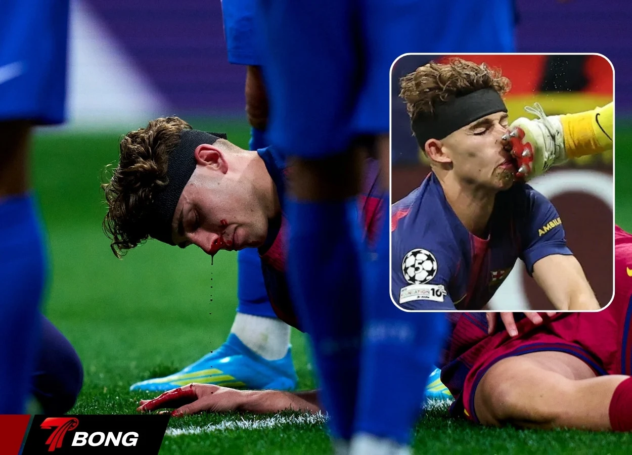 Fermin Lopez nằm sân sau va chạm mạnh