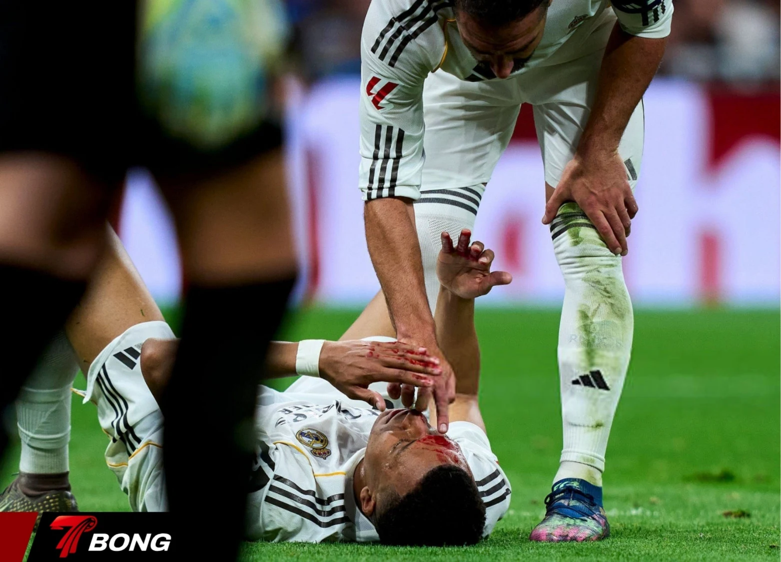 Mbappe ngã xuống sân sau va chạm mạnh