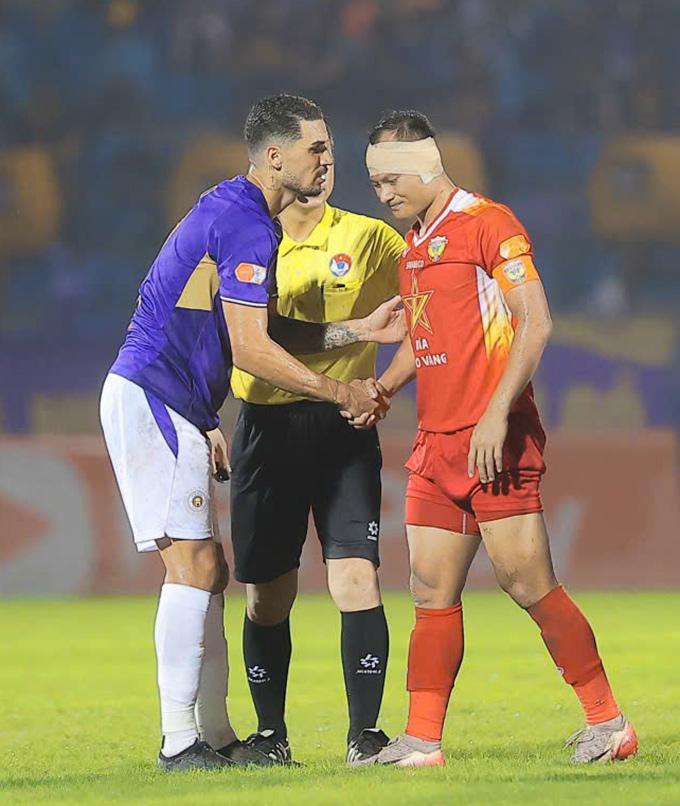 Trọng Hoàng bị giẫm rách tai, vẫn quật cường thi đấu đến cuối trận